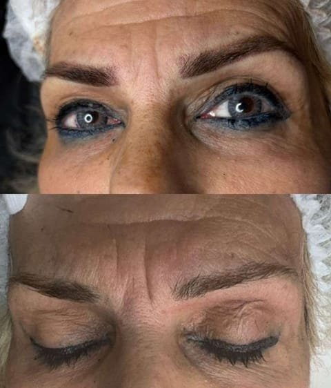 גבות לפני ואחרי איפור קבוע, שתי תמונות זו מעל זו