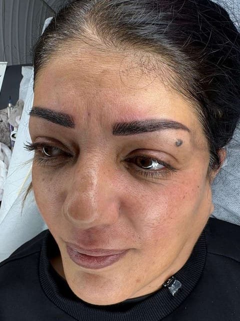 מטופלת לאחר איפור קבוע גבות, מבט מלפנים